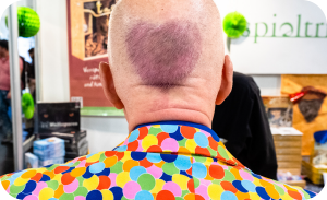 Ein Hinterkopf mit Haaren in Herzform